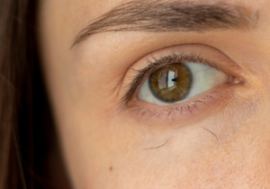 Cejas caídas