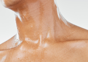 Hiperhidrosis