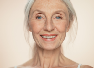 Flacidez facial