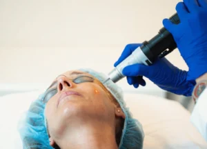 Láser de picosegundos