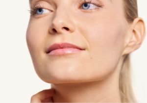  Flacidez facial