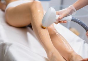 Depilación con Luz Pulsada Intensa IPL