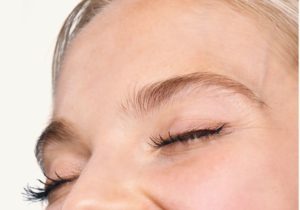 Microinjerto cejas