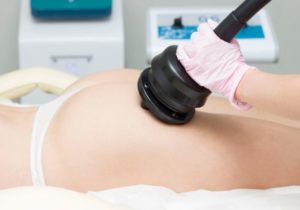 Terapia subdérmica