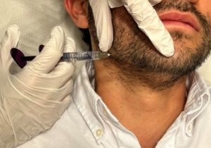 Ácido Hialurónico en Hombres
