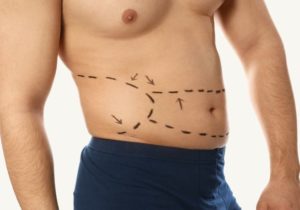 Lipotransferencia en el Hombre