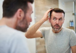 Microinjerto capilar en Hombres