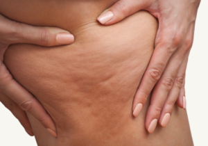 Precios Velashape