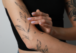 Eliminar Tatuajes