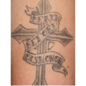 Antes y después de Picosure en tatuaje - 4 sesiones