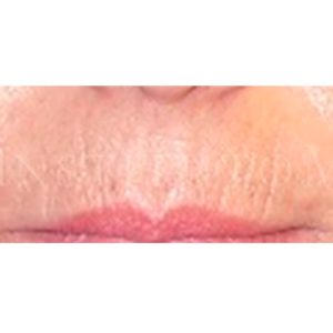 Antes y después de eliminar el código de barras en labios
