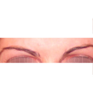 Antes y después un tratamiento de Simetrización de cejas