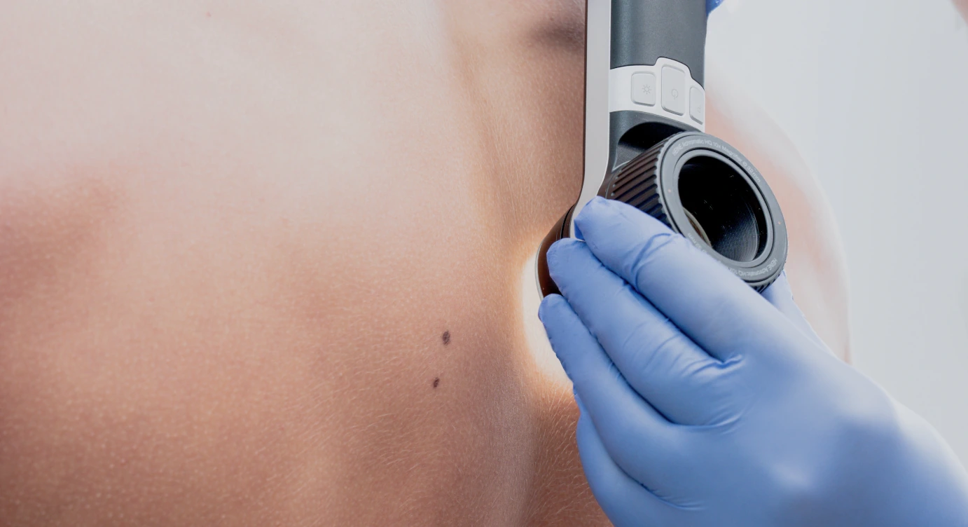 Skin Check   Revisión integral de tu piel Diagnóstico.Prevención.Rutina personalizada. 
