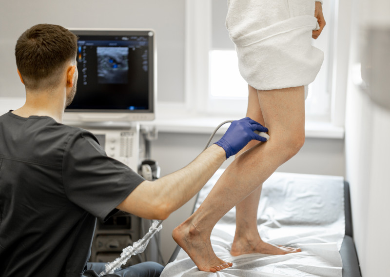 Varices: 8 mitos que debes dejar de creer