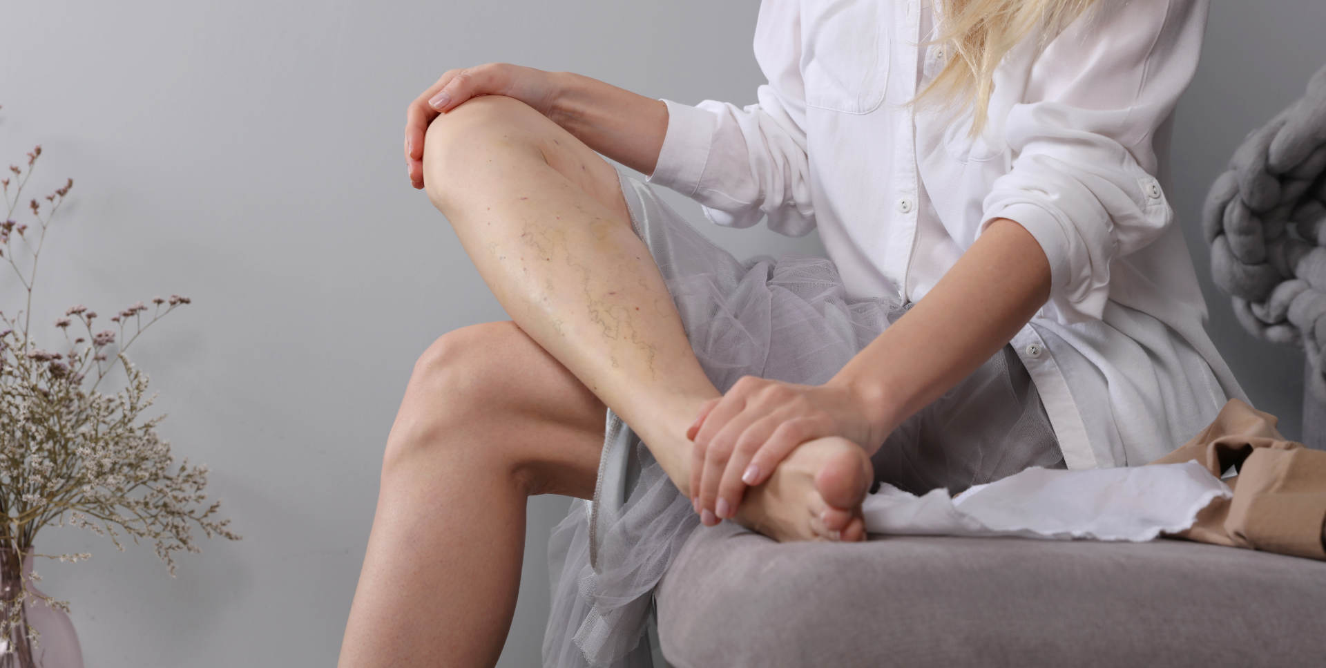 ¿Qué tipos de varices existen?